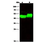 alpha Galactosidase Recombinant Rabbit Monoclonal Antibody (201)