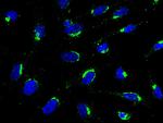 GOLPH2 Monoclonal Antibody (30)
