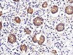 A33 Recombinant Rabbit Monoclonal Antibody (071)