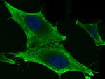 GSTM2 Recombinant Rabbit Monoclonal Antibody (006)