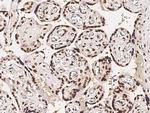 HSF1 Antibody in Immunohistochemistry (Paraffin) (IHC (P))