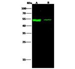 IFNAR2 Recombinant Rabbit Monoclonal Antibody (123)