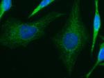 IVD Monoclonal Antibody (04)