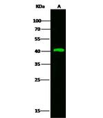 Kallikrein 11 Recombinant Rabbit Monoclonal Antibody (121)