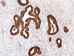 PSA Antibody in Immunohistochemistry (Paraffin) (IHC (P))