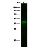 Kallikrein 8 Recombinant Rabbit Monoclonal Antibody (140)
