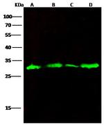 Galectin 3 Recombinant Rabbit Monoclonal Antibody (078)