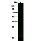 LSM1 Recombinant Rabbit Monoclonal Antibody (022)