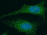 LUM Recombinant Rabbit Monoclonal Antibody (077)