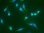 JNK2 Recombinant Rabbit Monoclonal Antibody (011)