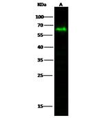 MICB Recombinant Rabbit Monoclonal Antibody (102)