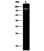 MMP2 Recombinant Rabbit Monoclonal Antibody (026)