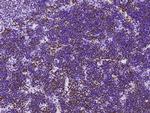 MSH6 Antibody in Immunohistochemistry (Paraffin) (IHC (P))