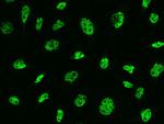 MSH6 Recombinant Rabbit Monoclonal Antibody (021)