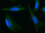 ARD1A Monoclonal Antibody (08)
