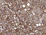 Nectin 3 Antibody in Immunohistochemistry (Paraffin) (IHC (P))