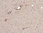 Neuroligin 1 Recombinant Rabbit Monoclonal Antibody (079)