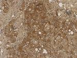NME1 Antibody in Immunohistochemistry (Paraffin) (IHC (P))