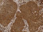 NME1 Antibody in Immunohistochemistry (Paraffin) (IHC (P))
