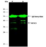 NT5C3A Antibody in Immunoprecipitation (IP)