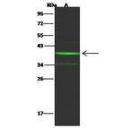 NT5C3A Antibody in Western Blot (WB)