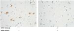 TrkA Recombinant Rabbit Monoclonal Antibody (024)