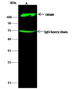 OSMR Monoclonal Antibody (8F3H8B2)