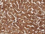 PDGFRB Antibody in Immunohistochemistry (Paraffin) (IHC (P))