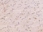 PDGFRB Antibody in Immunohistochemistry (Paraffin) (IHC (P))