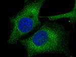 ERP72 Recombinant Rabbit Monoclonal Antibody (004)