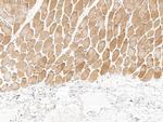 PHPT1 Antibody in Immunohistochemistry (Paraffin) (IHC (P))