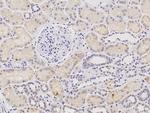 PHYH Monoclonal Antibody (03)