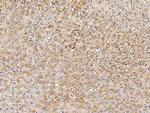 PMVK Antibody in Immunohistochemistry (Paraffin) (IHC (P))