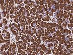 PNLIP Recombinant Rabbit Monoclonal Antibody (120)