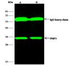 PNP Antibody in Immunoprecipitation (IP)