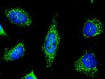 PRDX5 Recombinant Rabbit Monoclonal Antibody (002)