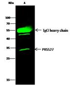 PRSS27 Antibody in Immunoprecipitation (IP)