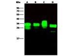 PSME1 Recombinant Rabbit Monoclonal Antibody (016)