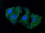 TNFRSF19L Monoclonal Antibody (01)