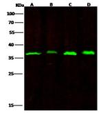RPRD1B Monoclonal Antibody (01)