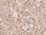 RPRD1B Antibody in Immunohistochemistry (Paraffin) (IHC (P))