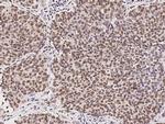 RPRD1B Monoclonal Antibody (08)