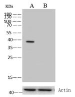 p53R2 Monoclonal Antibody (04)