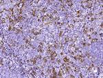 p53R2 Antibody in Immunohistochemistry (Paraffin) (IHC (P))