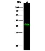 p53R2 Recombinant Rabbit Monoclonal Antibody (074)
