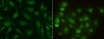 S100A13 Monoclonal Antibody (7G1A1G11)