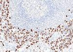 S100A8 Recombinant Rabbit Monoclonal Antibody (101)