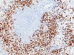 S100A9 Antibody in Immunohistochemistry (Paraffin) (IHC (P))