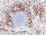 S100P Antibody in Immunohistochemistry (Paraffin) (IHC (P))