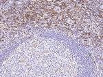 CD162 Recombinant Rabbit Monoclonal Antibody (031)
